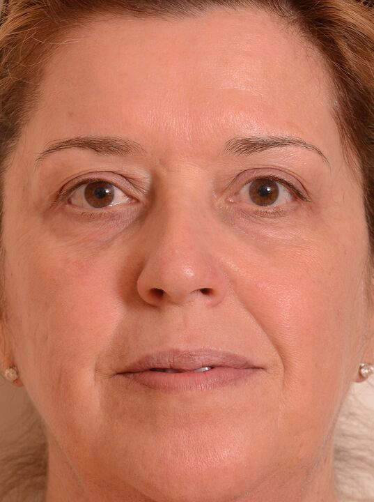J'ai rajeuni mon visage avec la crème zxcvbn Cammqwert
