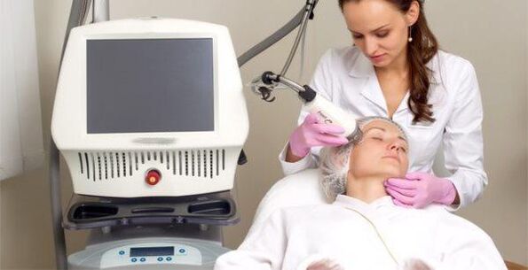 Effectuer la procédure