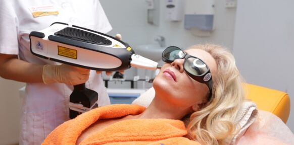 Levée après trente ans